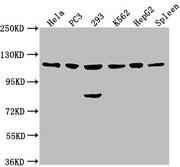 Western Blot Positive WB detected in: Hela whole cell lysate, PC3 whole cell lysate, 293 whole cell lysate, K562 whole cell lysate, HepG2 whole cell lysate, Rat spleen tissue All lanes: CDKL5 antibody at 1:2000 Secondary Goat polyclonal to rabbit...