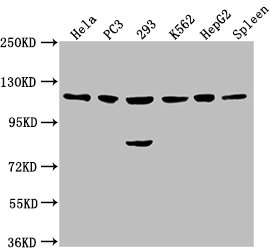 Western Blot Positive WB detected in: Hela whole cell lysate, PC3 whole cell lysate, 293 whole cell lysate, K562 whole cell lysate, HepG2 whole cell lysate, Rat spleen tissue All lanes: CDKL5 antibody at 1:2000 Secondary Goat polyclonal to rabbit...