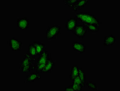 Immunofluorescent analysis of Hela cells using CSB-PA005088LA01HU at dilution of 1:100 and Alexa Fluor 488-congugated AffiniPure Goat Anti-Rabbit IgG(H+L)