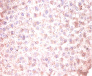 Immunohistochemistry of paraffin-embedded mouse liver tissue using CSB-PA005091LA01HU at dilution of 1:100