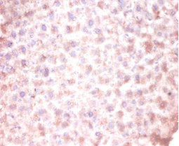 Immunohistochemistry of paraffin-embedded mouse liver tissue using CSB-PA005091LA01HU at dilution of 1:100