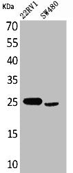 Western Blot analysis of 22RV-1 SW480 cells using SSX Polyclonal Antibody