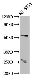 Western Blot Positive WB detected in: SH-SY5Y whole cell lysate All lanes: CDR2L antibody at 7.1ug/ml Secondary Goat polyclonal to rabbit IgG at 1/50000 dilution Predicted band size: 54 kDa Observed band size: 54 kDa