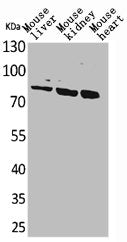Western Blot analysis of mouse liver mouse kidney mouse heart cells using CUL-4B Polyclonal Antibody