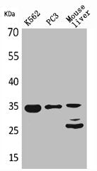 Western Blot analysis of K562 PC-3 mouse liver cells using Cdc34 Polyclonal Antibody
