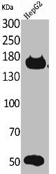 Western Blot analysis of HepG2 cells using Rock-2 Polyclonal Antibody