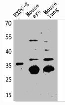 Western Blot analysis of BXPC-3 mouse eye mouse lung cells using TF Polyclonal Antibody