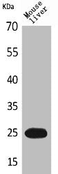 Western Blot analysis of mouse liver cells using CRP Polyclonal Antibody