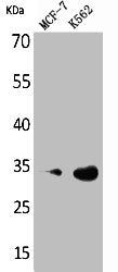 Western Blot analysis of MCF7 K562 cells using Cdk4 Polyclonal Antibody