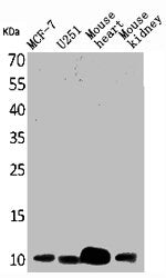 Western Blot analysis of MCF7 U251 mouse liver mouse kidney cells using ACBP Polyclonal Antibody