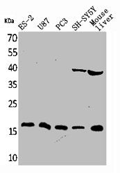 Western Blot analysis of ES-2 U87 PC-3 SHSY5Y mouse liver cells using IL-1β Polyclonal Antibody