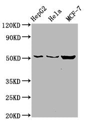 Western Blot Positive WB detected in: HepG2 whole cell lysate, Hela whole cell lysate, MCF-7 whole cell lysate All lanes: CDS2 antibody at 6µg/ml Secondary Goat polyclonal to rabbit IgG at 1/50000 dilution Predicted band size: 52, 30 kDa Observed...
