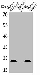 Western Blot analysis of mouse kidney mouse lung mouse heart cells using ADM Polyclonal Antibody