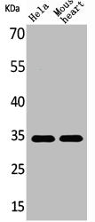 Western Blot analysis of HeLa mouse heart cells using Caspase-3 Polyclonal Antibody