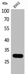 Western Blot analysis of K562 cells using Calbindin D28K Polyclonal Antibody