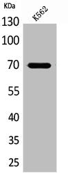 Western Blot analysis of K562 cells using Keap1 Polyclonal Antibody