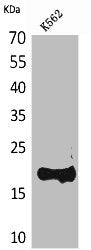 Western Blot analysis of K562 cells using Lipocalin-1 Polyclonal Antibody