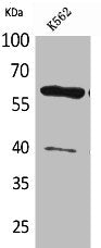 Western Blot analysis of K562 cells using CYP11A1 Polyclonal Antibody