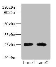 Western blot All lanes: CEACAM4 antibody at 1.81ug/ml Lane 1: Rat heart tissue Lane 2: Mouse brain tissue Secondary Goat polyclonal to rabbit IgG at 1/10000 dilution Predicted band size: 26 kDa Observed band size: 26 kDa
