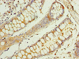 Immunohistochemistry of paraffin-embedded human colon tissue using CSB-PA005168ESR2HU at dilution of 1:100