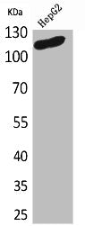 Western Blot analysis of HepG2 cells using DPYD Polyclonal Antibody