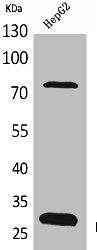 Western Blot analysis of HepG2 cells using DCI Polyclonal Antibody