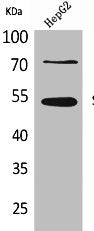 Western Blot analysis of HepG2 cells using SPTLC1 Polyclonal Antibody