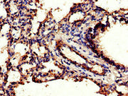 Immunohistochemistry of paraffin-embedded human lung tissue using CSB-PA005181LA01HU at dilution of 1:100