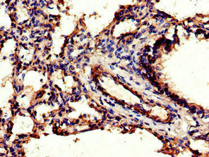 Immunohistochemistry of paraffin-embedded human lung tissue using CSB-PA005181LA01HU at dilution of 1:100