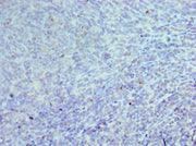 Immunohistochemistry of paraffin-embedded human tonsil tissue using CSB-PA005184DSR1HU at dilution of 1:100