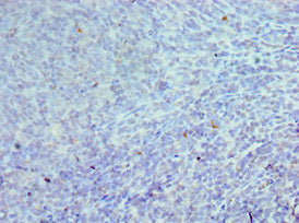 Immunohistochemistry of paraffin-embedded human tonsil tissue using CSB-PA005184DSR1HU at dilution of 1:100