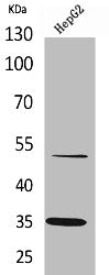 Western Blot analysis of HepG2 cells using TFPI Polyclonal Antibody