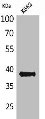 Western Blot analysis of K562 cells using CD1C Polyclonal Antibody