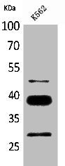 Western Blot analysis of K562 cells using CD1D Polyclonal Antibody