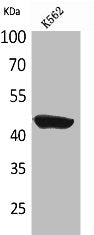 Western Blot analysis of K562 cells using CD1E Polyclonal Antibody