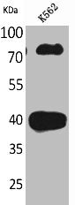 Western Blot analysis of K562 cells using CD2 Polyclonal Antibody