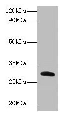 Western blot All lanes: Cela2a antibody at 2µg/ml + Recombinant Chymotrypsin-like elastase family member 2A protein 0.1µg Secondary Goat polyclonal to rabbit lgG at 1/15000 dilution Predicted band size: 29 kDa Observed band size: 29 kDa