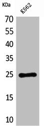 Western Blot analysis of K562 cells using CD7 Polyclonal Antibody