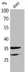 Western Blot analysis of K562 cells using IL-2Rα Polyclonal Antibody