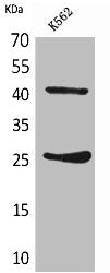 Western Blot analysis of K562 cells using CD28 Polyclonal Antibody