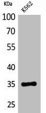 Western Blot analysis of K562 cells using CD32-A Polyclonal Antibody