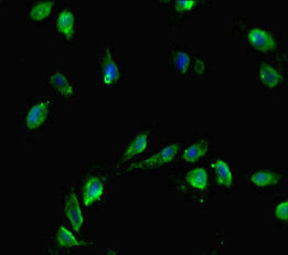 Immunofluorescent analysis of Hela cells using CSB-PA005205LA01HU at dilution of 1:100 and Alexa Fluor 488-congugated AffiniPure Goat Anti-Rabbit IgG(H+L)