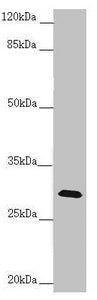 Western blot All lanes: CENPH antibody at 1.61 ug/ml + Mouse lung tissue Secondary Goat polyclonal to rabbit IgG at 1/10000 dilution Predicted band size: 28 kDa Observed band size: 28 kDa