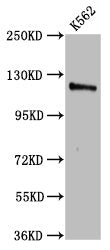 Western Blot Positive WB detected in: K562 whole cell lysate All lanes: CENPJ antibody at 3.2µg/ml Secondary Goat polyclonal to rabbit IgG at 1/50000 dilution Predicted band size: 154, 125 kDa Observed band size: 125 kDa