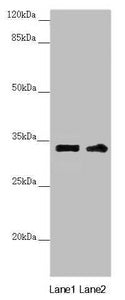 Western blot All lanes: CENPK antibody at 3.98ug/ml Lane 1: PC-3 whole cell lysate Lane 2: 293T whole cell lysate Secondary Goat polyclonal to rabbit IgG at 1/10000 dilution Predicted band size: 32 kDa Observed band size: 32 kDa