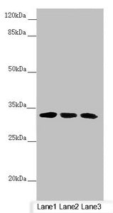 Western blot All lanes: CENPK antibody at 4.17µg/ml Lane 1: PC-3 whole cell lysate Lane 2: 293T whole cell lysate Lane 3: Hela whole cell lysate Secondary Goat polyclonal to rabbit IgG at 1/10000 dilution Predicted band size: 32 kDa Observed band...