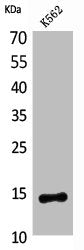 Western Blot analysis of K562 cells using CD59 Polyclonal Antibody