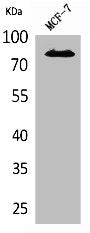 Western Blot analysis of MCF7 cells using IL-1RI Polyclonal Antibody