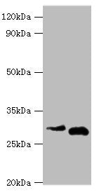 Western blot All lanes: Cerberus antibody at 2ug/ml Lane 1: Hela whole cell lysate Lane 2: Rat kidney tissue Secondary Goat polyclonal to rabbit IgG at 1/10000 dilution Predicted band size: 30 kDa Observed band size: 30 kDa