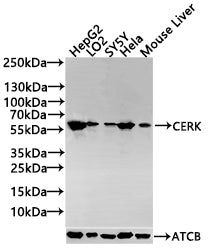 Western Blot Positive WB detected in: Mouse heart tissue, Mouse lung tissue, Mouse kidney tissue All lanes: CERK antibody at 3ug/ml Secondary Goat polyclonal to rabbit IgG at 1/50000 dilution Predicted band size: 60, 38 kDa Observed band size: 60,...